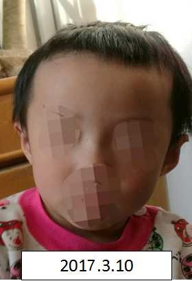 第一次插入视频老外缅甸啪啪啪
